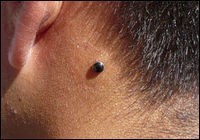 Microdermal derrière l'oreille