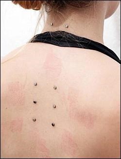 Microdermal corset dos